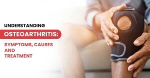 Understanding Osteoarthritis: Expert Guide on Causes, Symptoms, and Treatment Options