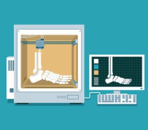 Autograft vs. Allograft vs. Synthetic Bone Graft Materials