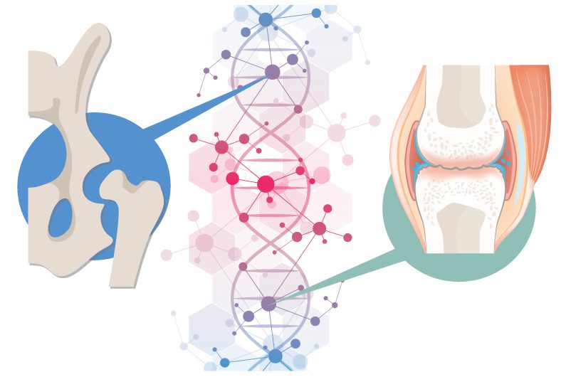 Genetics in Orthopedic Conditions