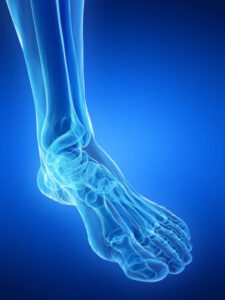 Knee and Ankle Cartilage Defects