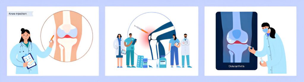 advances in cartilage regeneration