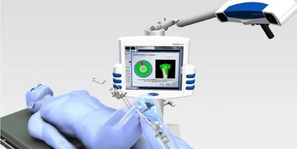 computer assisted navigation orthopedic surgery