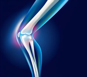 3D medical illustration of knee joint anatomy showing femur, tibia, and meniscus in blue and white gradient against dark background