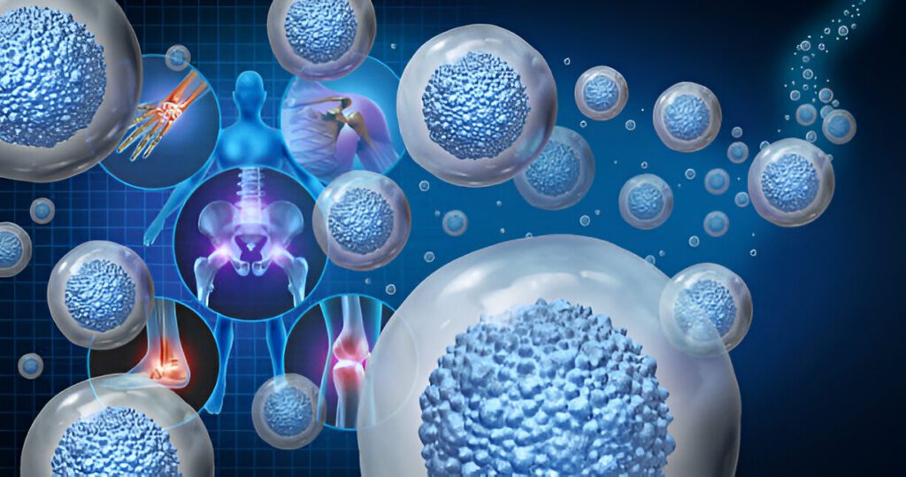 3D medical illustration showing stem cells surrounding a human skeletal system with highlighted joint areas and cellular activity