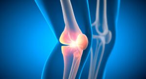 Side-by-side 3D illustration of normal and damaged knee meniscus