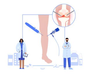 Medical illustration showing arthroscopic knee treatment with two doctors and surgical instruments