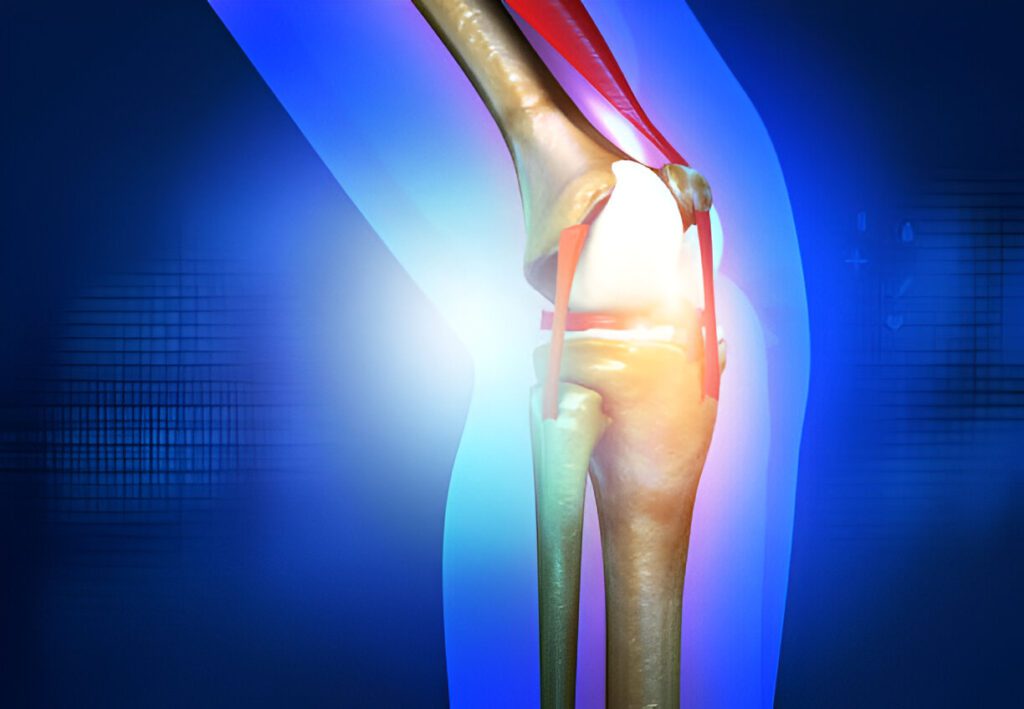 Medical 3D rendering of knee joint anatomy showing bone structure with highlighted inflammatory region in red