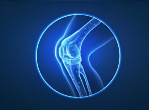 3D medical illustration of a knee joint with glowing blue skeletal structure against dark background