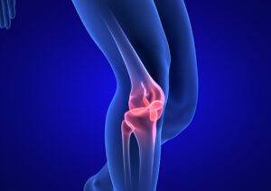 3D medical rendering of knee joint with highlighted pain areas in pink against blue anatomical structure