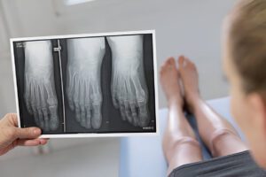 X-ray examination of foot anatomy during limb lengthening consultation, illustrating the importance of patient understanding and involvement in the surgical planning process.