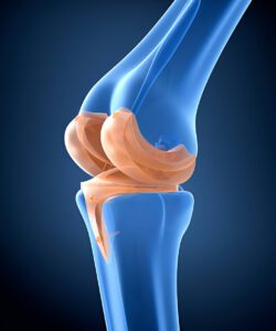 3D anatomical illustration of knee joint showing femur, tibia, and cartilage in blue and peach colors against dark background