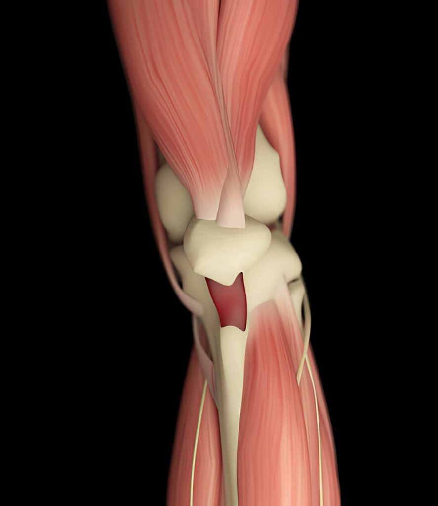 Anatomical 3D rendering of knee joint showing bones, cartilage, and muscle tissue in pink and beige colors against black background