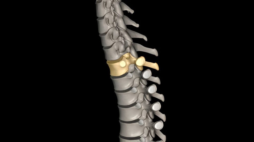 3D medical illustration of lumbar vertebrae showing detailed disc structure against black background