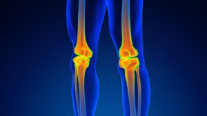 Dual knee visualization with thermal imaging showing bilateral comparison in orange and blue coloring